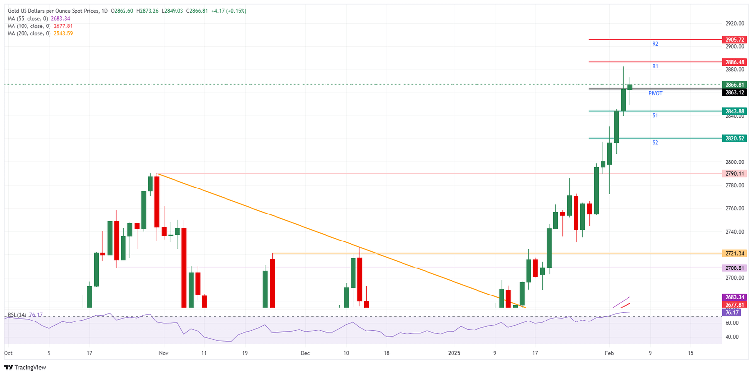 XAU/USD: Daily Chart